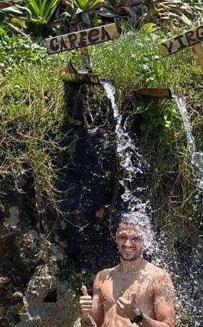 Tratamento da calvicie do Xenxo.